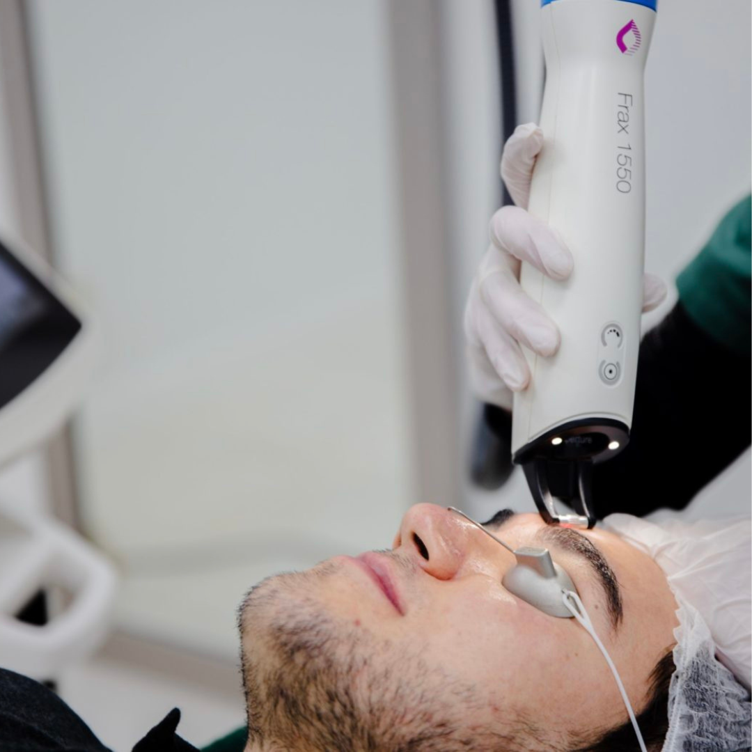 Is Frax Pro geschikt voor diepe acne-littekens?