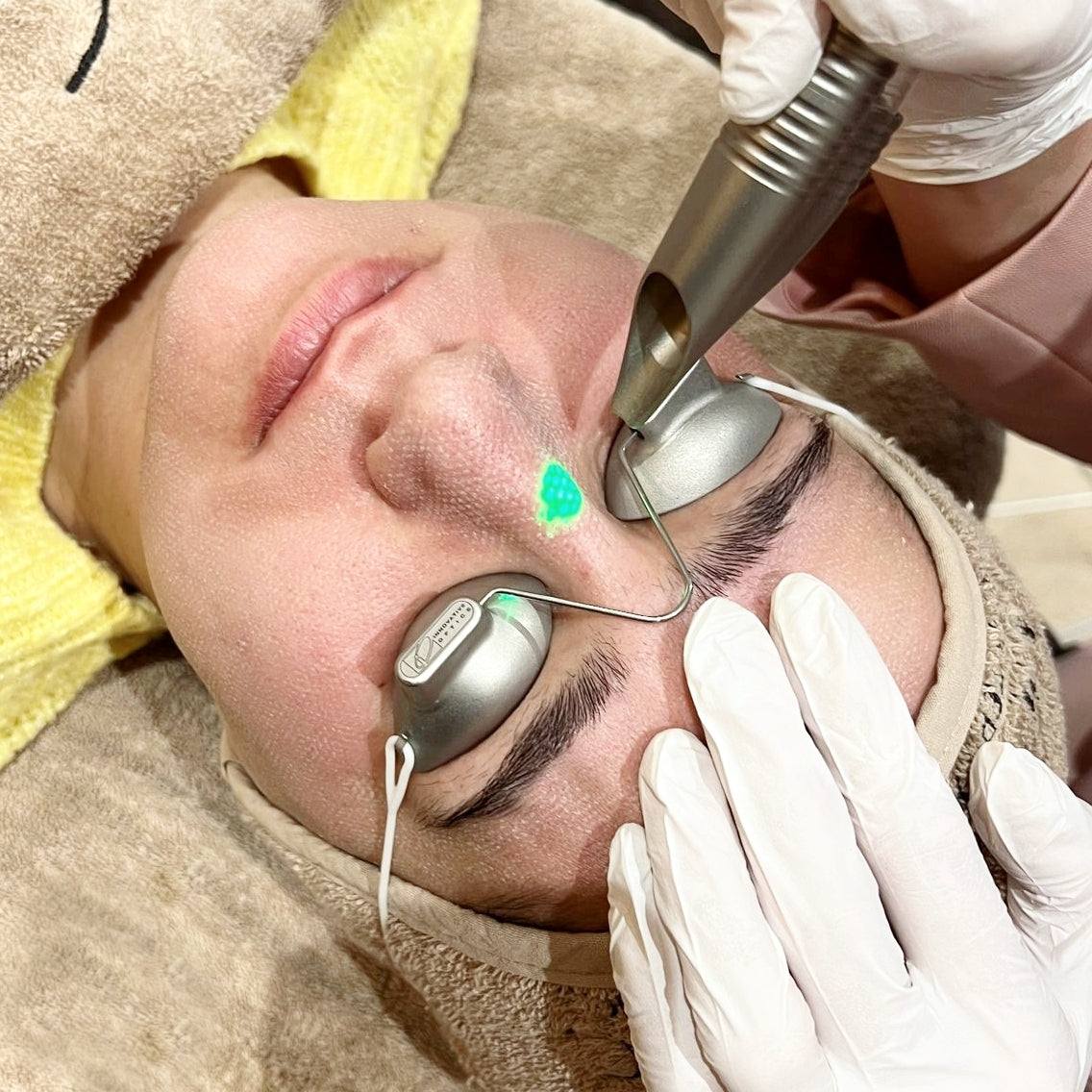 Wat helpt tegen rimpels zonder botox?
